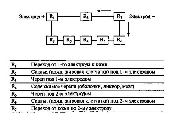 Электросудорожная терапия (ЭСТ)